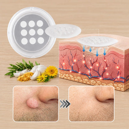✨🔥 50% SLEVA 🔥✨ PURESHADE® 2v1 mikrojehličková náplast 🍀 | Na znaménka, bradavice, akné a nedokonalosti pleti | Jemnější a čistší vzhled pokožky