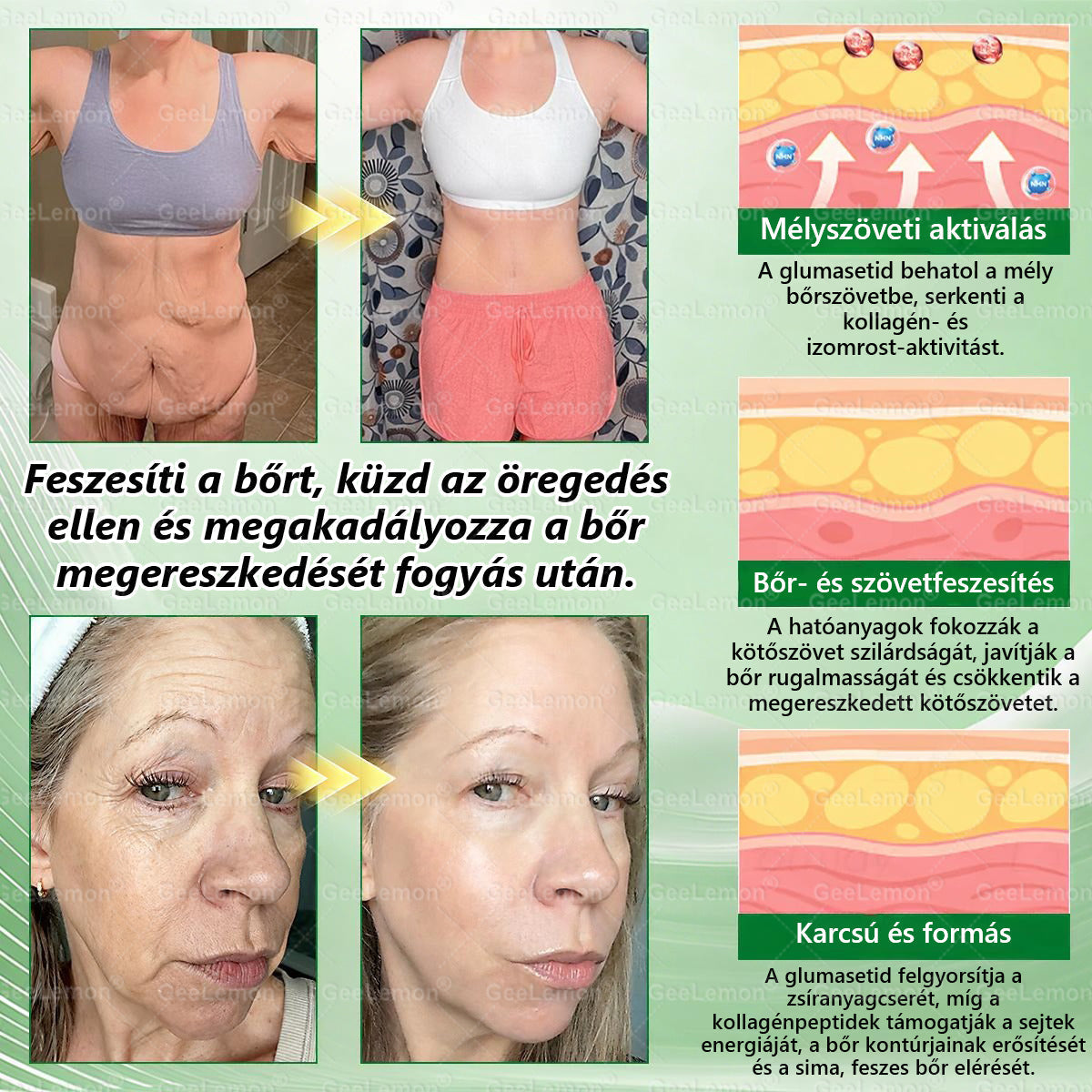 Magyar szakértők által ajánlott · 👩‍⚕️ Hivatalos márkabolt| 🎄✨ 𝐆𝐞𝑒𝐿𝑒𝐦𝐨𝐧® Glumasetide 8 az 1-ben Karcsú és Egészséges Nano Mikrotűs Tapasz 🇭🇺