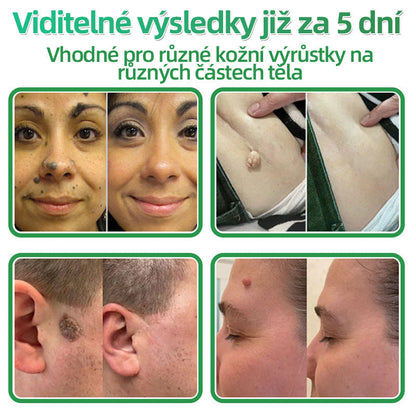 HAJUEI® 📌 𝟐𝐯𝟏 𝐡𝐲𝐝𝐫𝐨𝐤𝐨𝐥𝐨𝐢𝐝𝐧í 𝐧á𝐩𝐥𝐚𝐬𝐭𝐢 𝐬 𝐦𝐢𝐤𝐫𝐨𝐣𝐞𝐡𝐥𝐢č𝐤𝐚𝐦𝐢 | 𝐒𝐩𝐞𝐜𝐢á𝐥𝐧ě 𝐯𝐲𝐯𝐢𝐧𝐮𝐭é 𝐩𝐫𝐨 𝐨𝐝𝐬𝐭𝐫𝐚𝐧ě𝐧í 𝐯𝐲𝐬𝐭𝐨𝐮𝐩𝐥ý𝐜𝐡 𝐦𝐚𝐭𝐞ř𝐬𝐤ý𝐜𝐡 𝐳𝐧𝐚𝐦é𝐧𝐞𝐤, 𝐚𝐤𝐧é, 𝐩𝐥𝐨𝐜𝐡ý𝐜𝐡 𝐛𝐫𝐚𝐝𝐚𝐯𝐢𝐜 𝐚 𝐤𝐨ž𝐧í𝐜𝐡 𝐯ý𝐫ů𝐬𝐭𝐤ů | 𝐁𝐚𝐥𝐞𝐧í 𝟏𝟒𝟒 𝐤𝐮𝐬ů🌵🌵