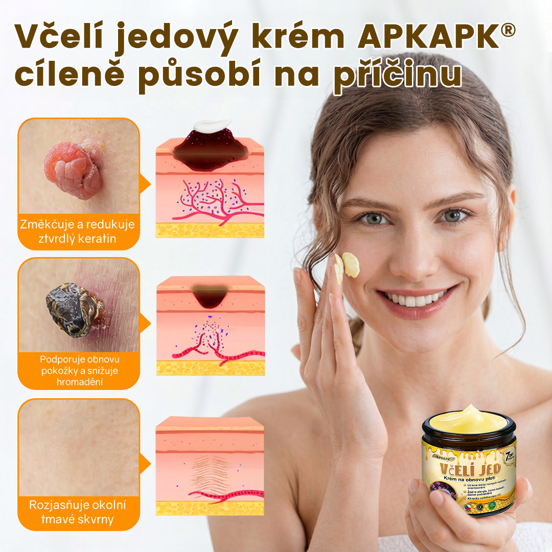 Bezbolestně a účinně odstraňuje různé typy bradavic 👨‍⚕️ APKAPK® krém na obnovu pokožky s včelím jedem pomáhá odstranit běžné, plantární, ploché a nitkovité bradavice, stejně jako papilomy
