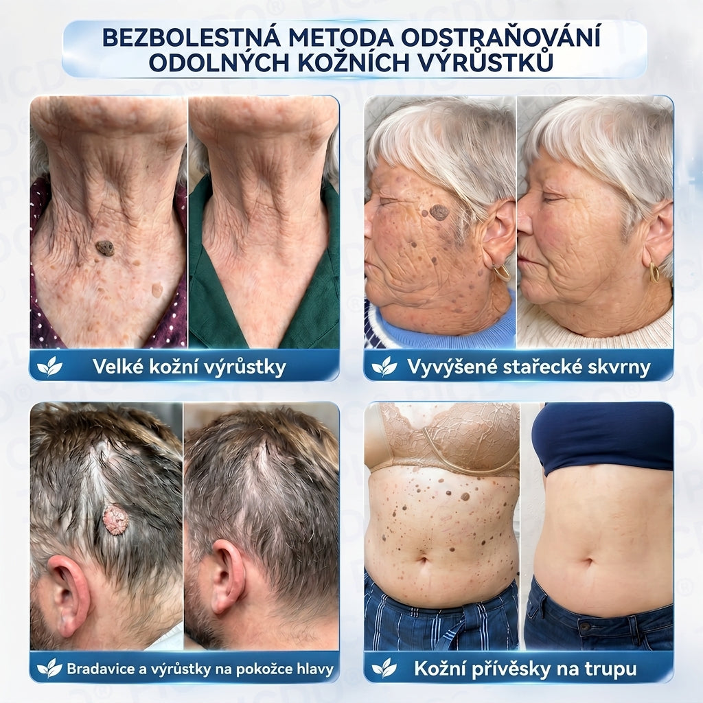 APKAPK® 𝟕𝐝𝐞𝐧𝐧í 𝐤𝐫é𝐦 𝐩𝐫𝐨𝐭𝐢 𝐤𝐨ž𝐧í𝐦 𝐯𝐲𝐫ů𝐬𝐭𝐤ů𝐦 𝐚 𝐩𝐢𝐠𝐦𝐞𝐧𝐭𝐨𝐯ý𝐦 𝐬𝐤𝐯𝐫𝐧á𝐦 (𝐁𝐞𝐳𝐛𝐨𝐥𝐞𝐬𝐭𝐧á 𝐟𝐨𝐫𝐦𝐮𝐥𝐞 – 𝐛𝐞𝐳 𝐣𝐢𝐳𝐞𝐯)🎉