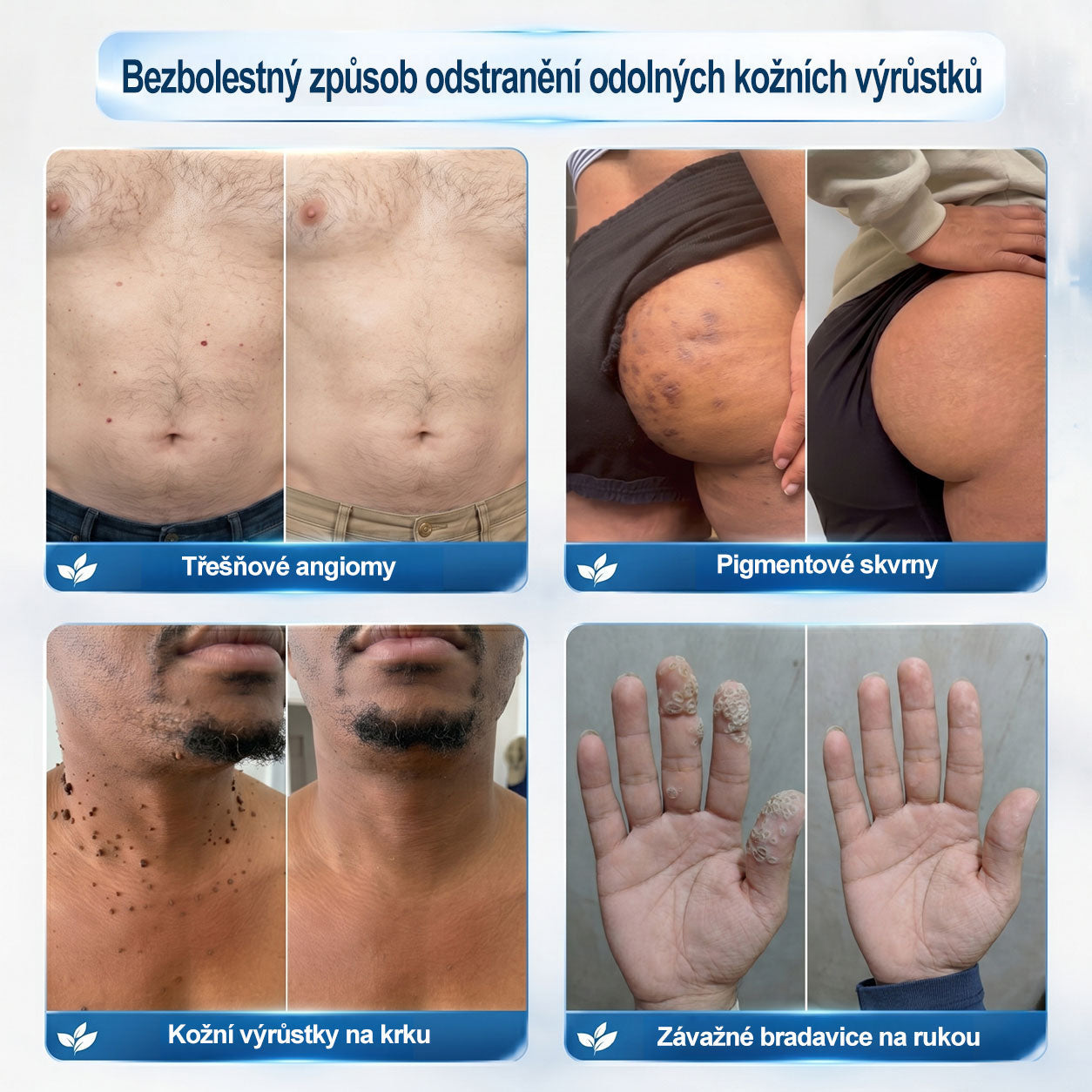 Oficiální značkový obchod | Hiskin® 7denní odstraňovač skvrn a pigmentových skvrn (Bezbolestný rollerball bez jizev)🐬