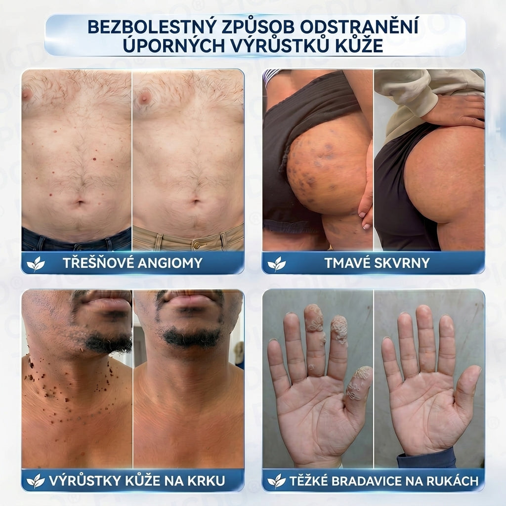 APKAPK® 𝟕𝐝𝐞𝐧𝐧í 𝐤𝐫é𝐦 𝐩𝐫𝐨𝐭𝐢 𝐤𝐨ž𝐧í𝐦 𝐯𝐲𝐫ů𝐬𝐭𝐤ů𝐦 𝐚 𝐩𝐢𝐠𝐦𝐞𝐧𝐭𝐨𝐯ý𝐦 𝐬𝐤𝐯𝐫𝐧á𝐦 (𝐁𝐞𝐳𝐛𝐨𝐥𝐞𝐬𝐭𝐧á 𝐟𝐨𝐫𝐦𝐮𝐥𝐞 – 𝐛𝐞𝐳 𝐣𝐢𝐳𝐞𝐯)🎉
