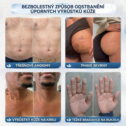 APKAPK® 𝟕𝐝𝐞𝐧𝐧í 𝐤𝐫é𝐦 𝐩𝐫𝐨𝐭𝐢 𝐤𝐨ž𝐧í𝐦 𝐯𝐲𝐫ů𝐬𝐭𝐤ů𝐦 𝐚 𝐩𝐢𝐠𝐦𝐞𝐧𝐭𝐨𝐯ý𝐦 𝐬𝐤𝐯𝐫𝐧á𝐦 (𝐁𝐞𝐳𝐛𝐨𝐥𝐞𝐬𝐭𝐧á 𝐟𝐨𝐫𝐦𝐮𝐥𝐞 – 𝐛𝐞𝐳 𝐣𝐢𝐳𝐞𝐯)🎉