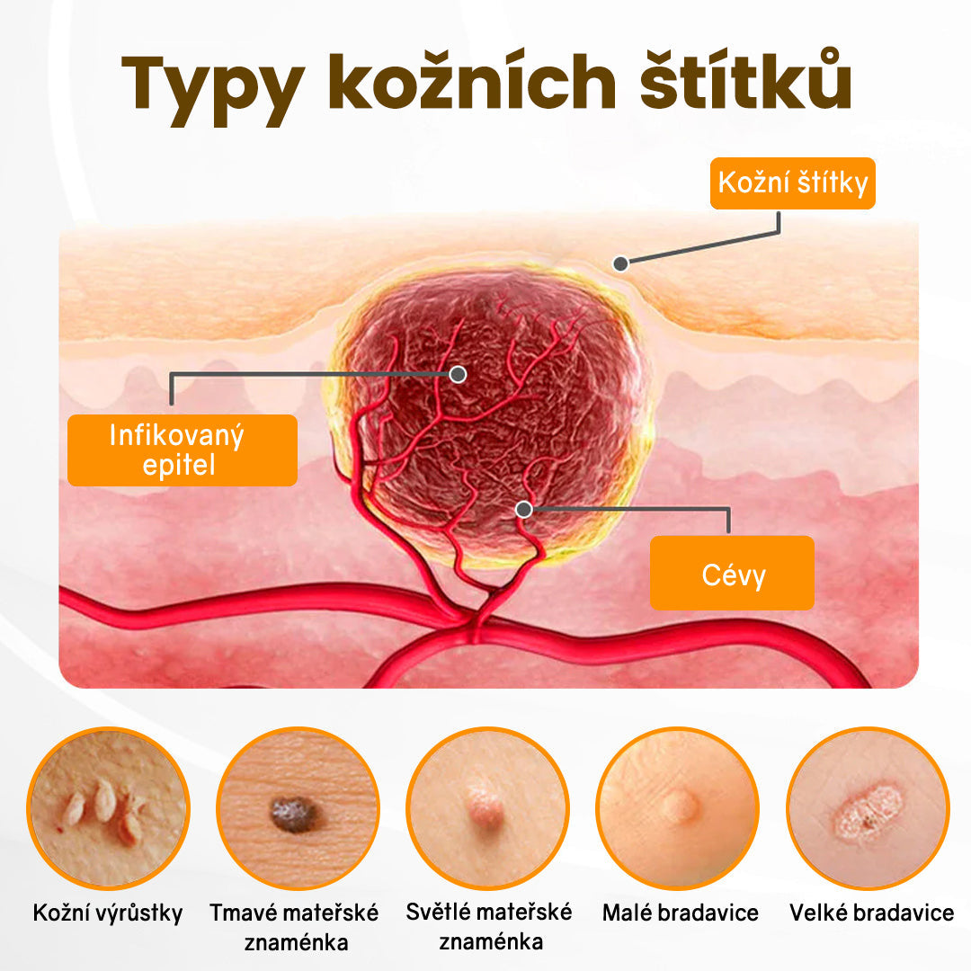 Bezbolestně a účinně odstraňuje různé typy bradavic 👨‍⚕️ APKAPK® krém na obnovu pokožky s včelím jedem pomáhá odstranit běžné, plantární, ploché a nitkovité bradavice, stejně jako papilomy