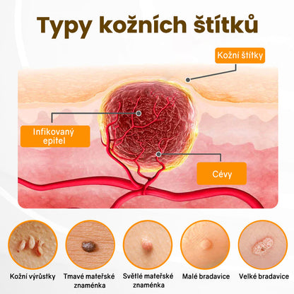Bezbolestně a účinně odstraňuje různé typy bradavic 👨‍⚕️ APKAPK® krém na obnovu pokožky s včelím jedem pomáhá odstranit běžné, plantární, ploché a nitkovité bradavice, stejně jako papilomy