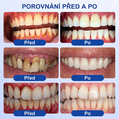 PureShade® 🦷 GumRevive regenerační gel na dásně – pro zdravější dásně a sebevědomější úsměv 👍