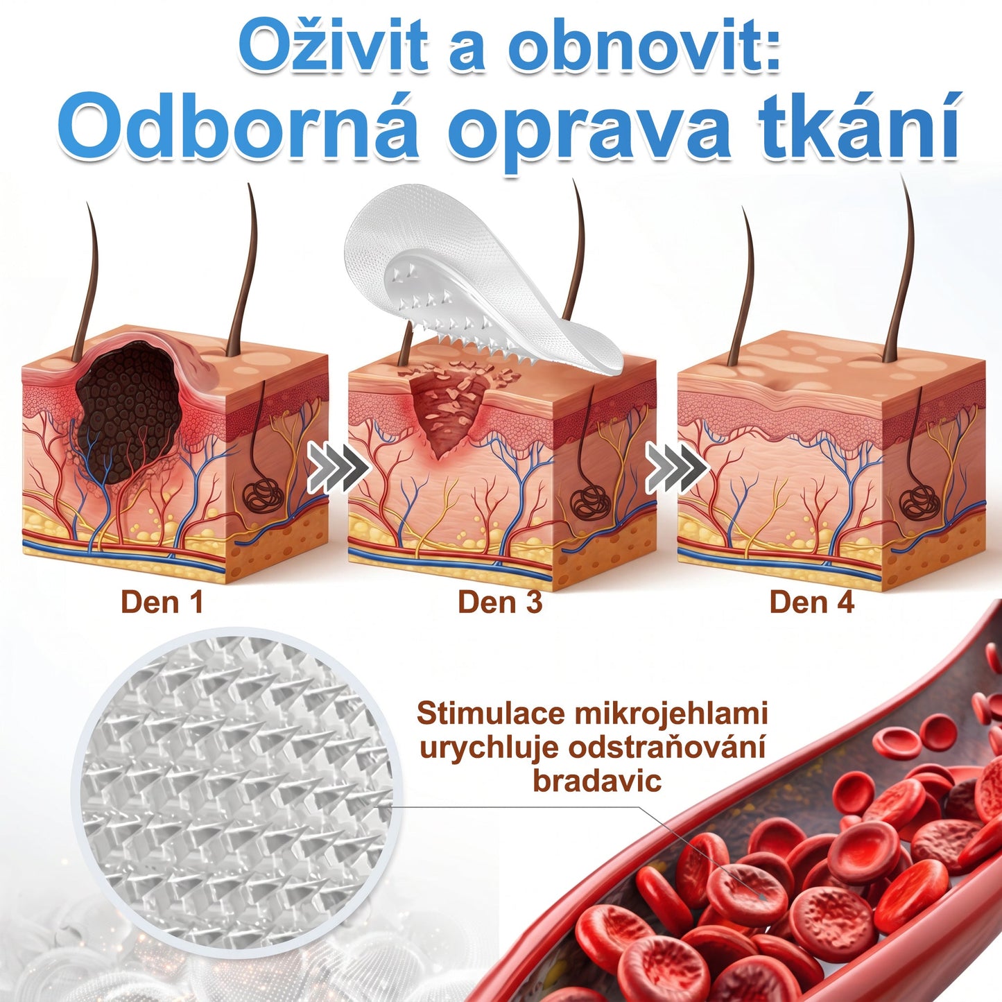 ✨🔥 50% SLEVA 🔥✨ PURESHADE® 2v1 mikrojehličková náplast 🍀 | Na znaménka, bradavice, akné a nedokonalosti pleti | Jemnější a čistší vzhled pokožky
