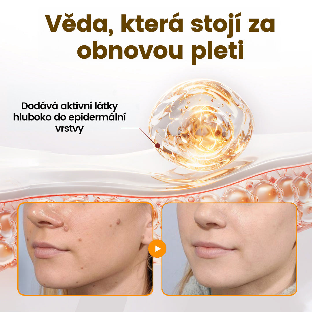 Bezbolestně a účinně odstraňuje různé typy bradavic 👨‍⚕️ APKAPK® krém na obnovu pokožky s včelím jedem pomáhá odstranit běžné, plantární, ploché a nitkovité bradavice, stejně jako papilomy
