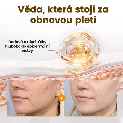 Bezbolestně a účinně odstraňuje různé typy bradavic 👨‍⚕️ APKAPK® krém na obnovu pokožky s včelím jedem pomáhá odstranit běžné, plantární, ploché a nitkovité bradavice, stejně jako papilomy