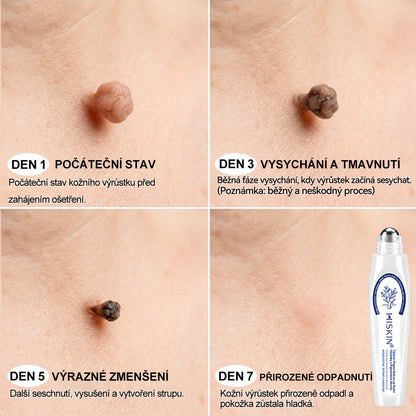 Oficiální značkový obchod | Hiskin® 7denní odstraňovač skvrn a pigmentových skvrn (Bezbolestný rollerball bez jizev)🐬