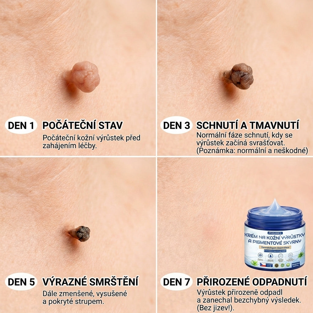 APKAPK® 𝟕𝐝𝐞𝐧𝐧í 𝐤𝐫é𝐦 𝐩𝐫𝐨𝐭𝐢 𝐤𝐨ž𝐧í𝐦 𝐯𝐲𝐫ů𝐬𝐭𝐤ů𝐦 𝐚 𝐩𝐢𝐠𝐦𝐞𝐧𝐭𝐨𝐯ý𝐦 𝐬𝐤𝐯𝐫𝐧á𝐦 (𝐁𝐞𝐳𝐛𝐨𝐥𝐞𝐬𝐭𝐧á 𝐟𝐨𝐫𝐦𝐮𝐥𝐞 – 𝐛𝐞𝐳 𝐣𝐢𝐳𝐞𝐯)🎉