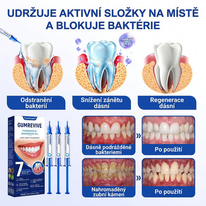 PureShade® 🦷 GumRevive regenerační gel na dásně – pro zdravější dásně a sebevědomější úsměv 👍