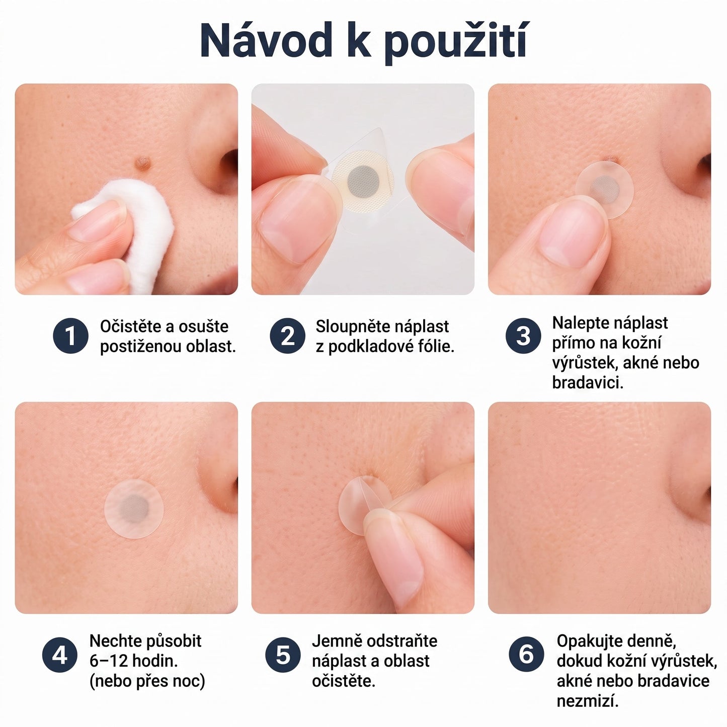 ✨🔥 50% SLEVA 🔥✨ PURESHADE® 2v1 mikrojehličková náplast 🍀 | Na znaménka, bradavice, akné a nedokonalosti pleti | Jemnější a čistší vzhled pokožky