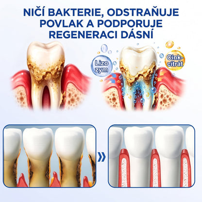PureShade® 🦷 GumRevive regenerační gel na dásně – pro zdravější dásně a sebevědomější úsměv 👍