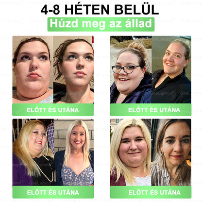Magyar szakértők által ajánlott · 👩‍⚕️ Hivatalos márkabolt| 🩹 𝐆𝐞𝑒𝐿𝑒𝐦𝐨𝐧® Glumasetide 8 az 1-ben Karcsú és Egészséges Nano Mikrotűs Tapasz 🇭🇺