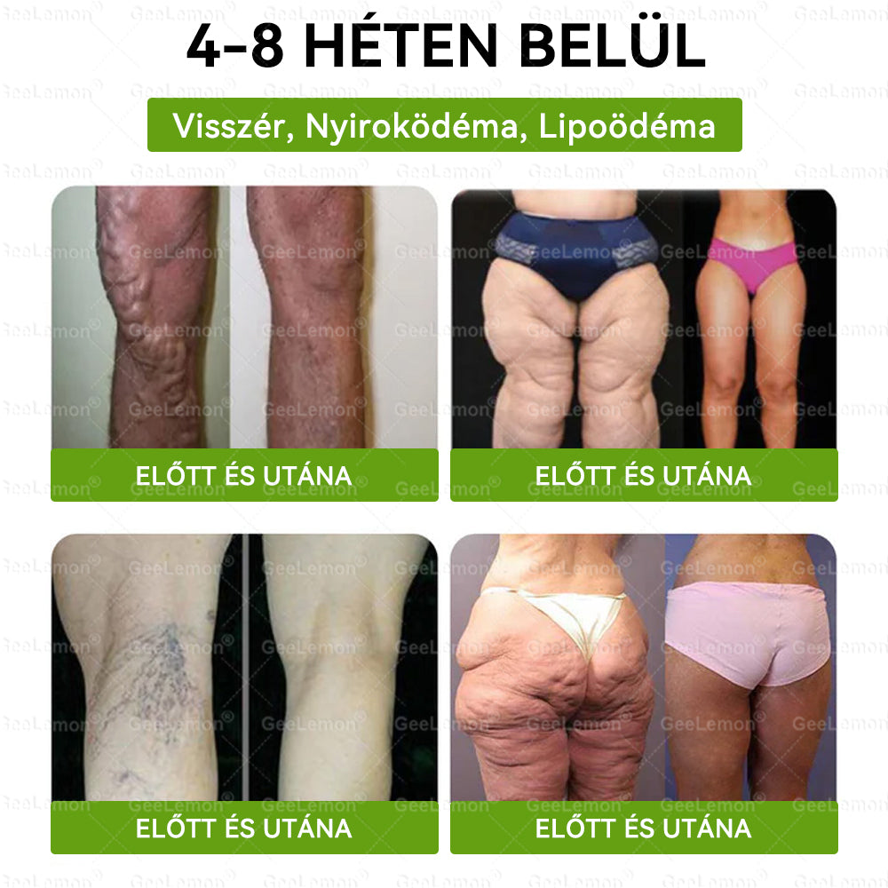 EZ AZ AJÁNLAT NEM VÁR ⏳ MOST −50% KEDVEZMÉNY 🔥 A KÉSZLET FOGY A VISSZASZÁMLÁLÁS MEGY AKI HABOZIK KÉSŐBB TÖBBET FIZET LÉPJ MOST