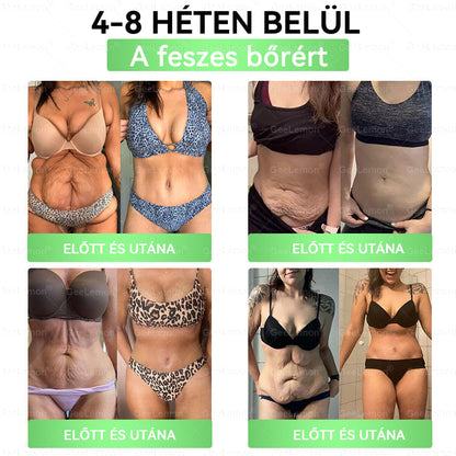 Magyar szakértők által ajánlott · 👩‍⚕️ Hivatalos márkabolt| 🩹 𝐆𝐞𝑒𝐿𝑒𝐦𝐨𝐧® Glumasetide 8 az 1-ben Karcsú és Egészséges Nano Mikrotűs Tapasz 🇭🇺
